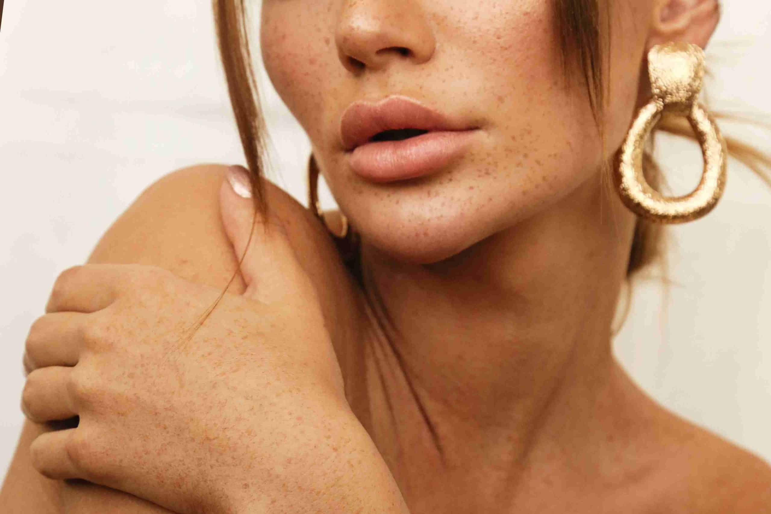 Women Receiving Facial Fillers Treatment In Brooklyn, NY by PBK Medspa