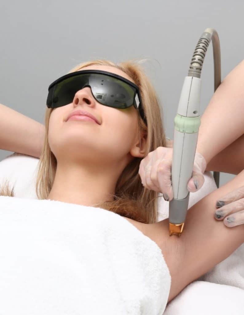 Laser Hair removal