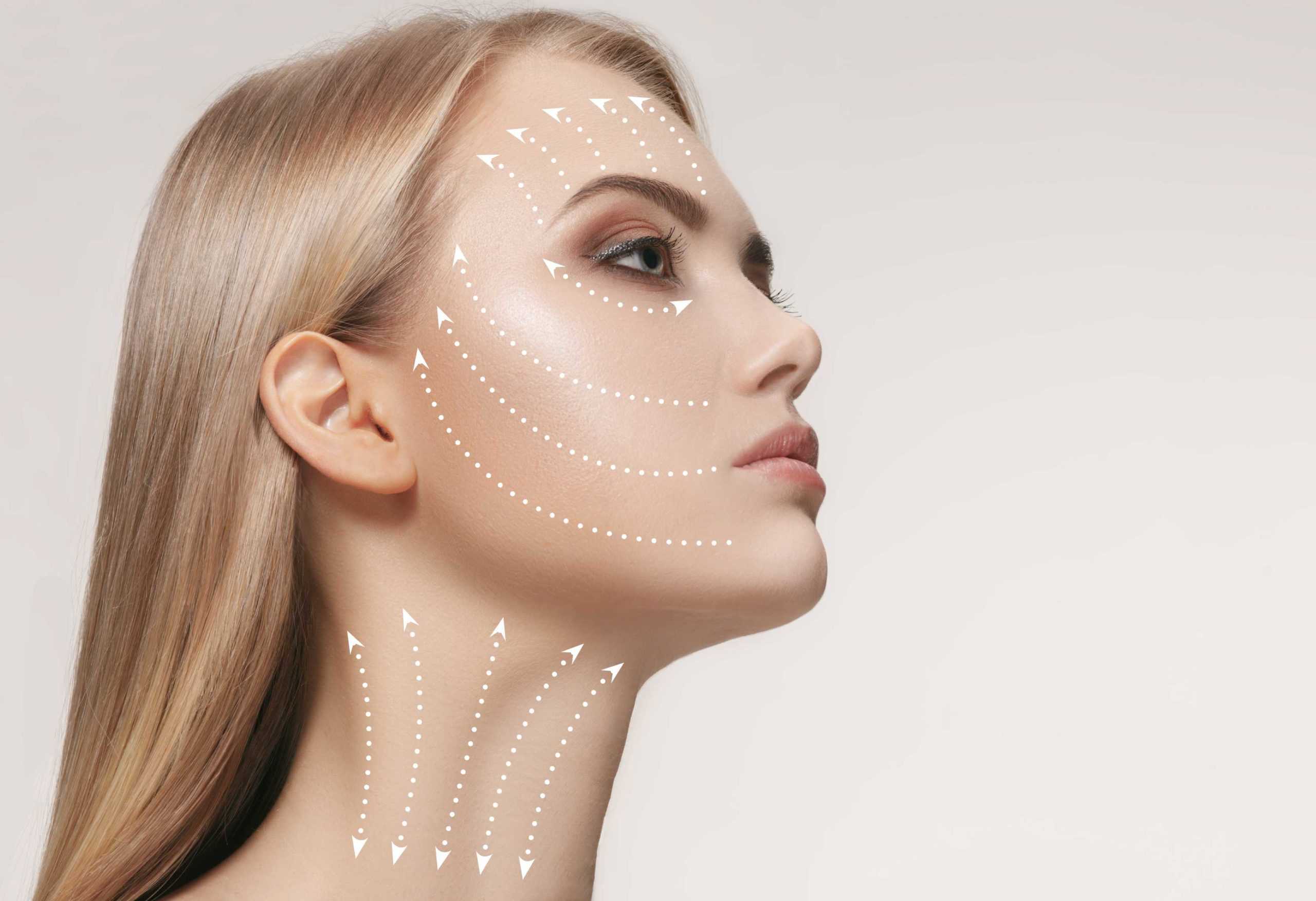 Women Receiving PDO Threads Services In Brooklyn, NY by PBK Medspa
