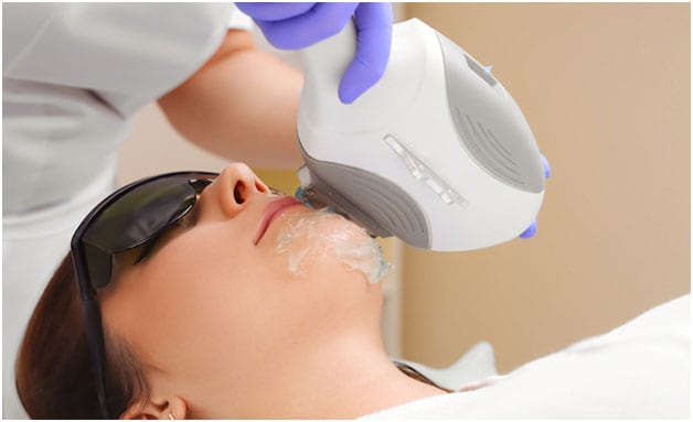 IPL Pigmentation