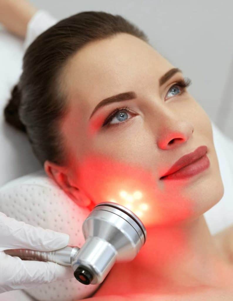 Acne laser & Light treatment