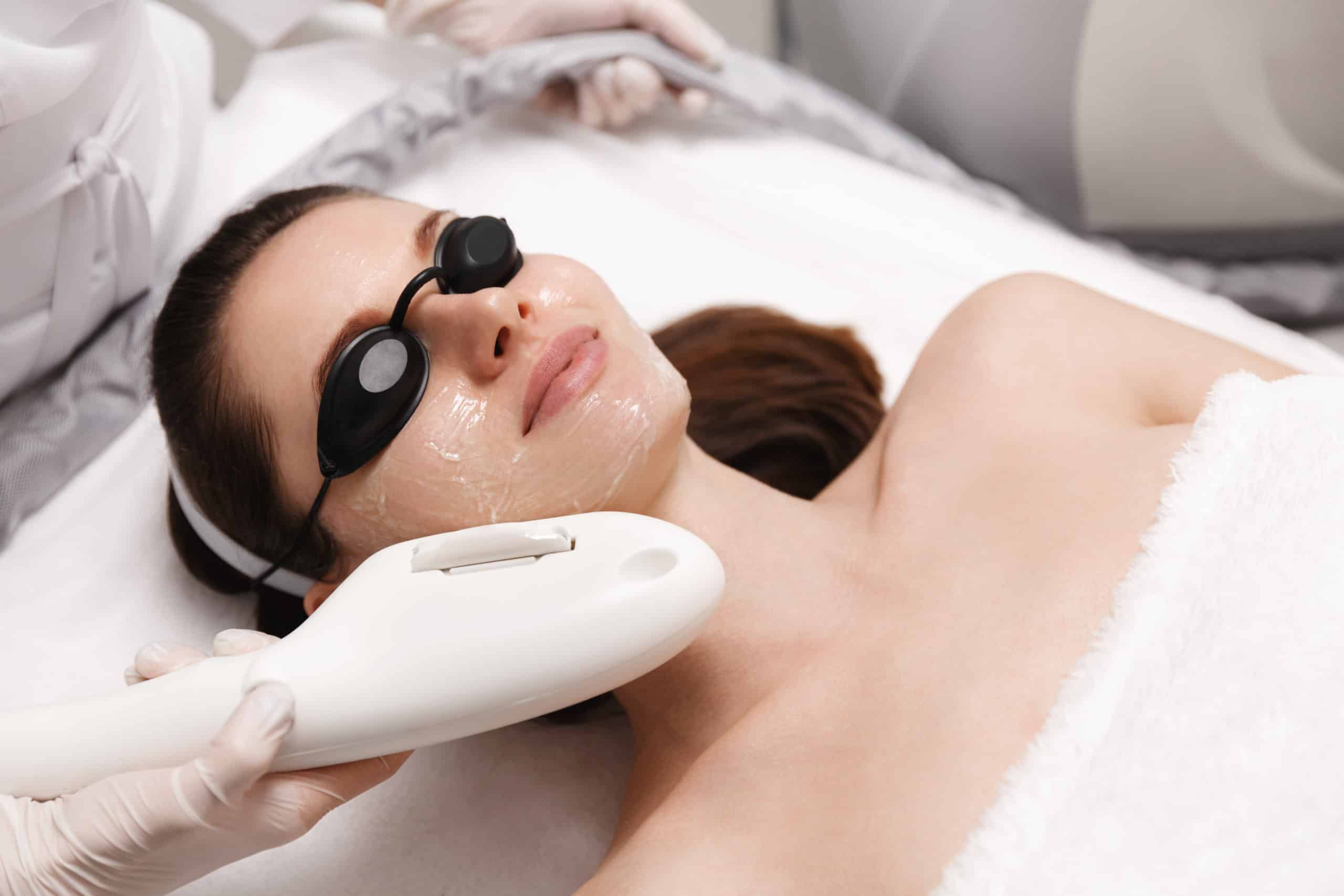 Is It Safe To Get A Photofacial Done To Get Rid Of Prolonged Tanning
