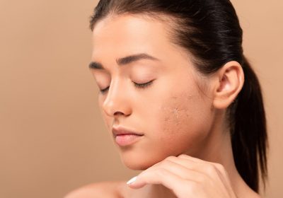 Photofacial / IPL – PBK Medspa | Brooklyn, NY Photofacial